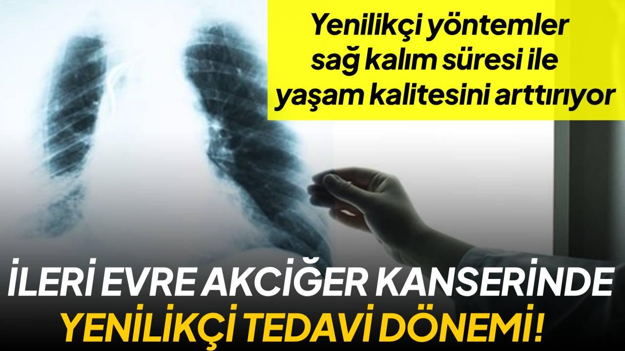 Otomatik Taslak