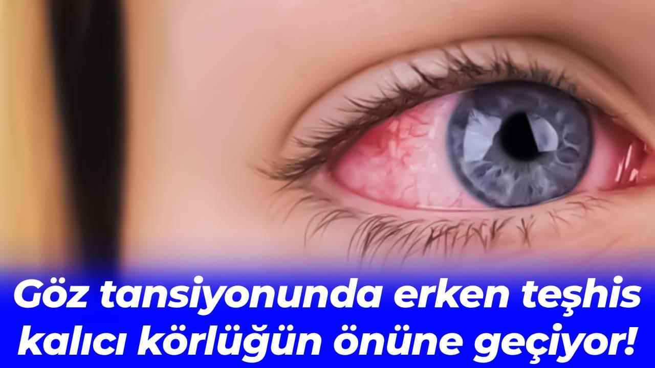 Otomatik Taslak